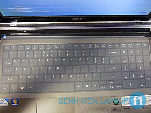 Cấp cứu laptop bị nước vào - Sửa chữa laptop tại Vinh